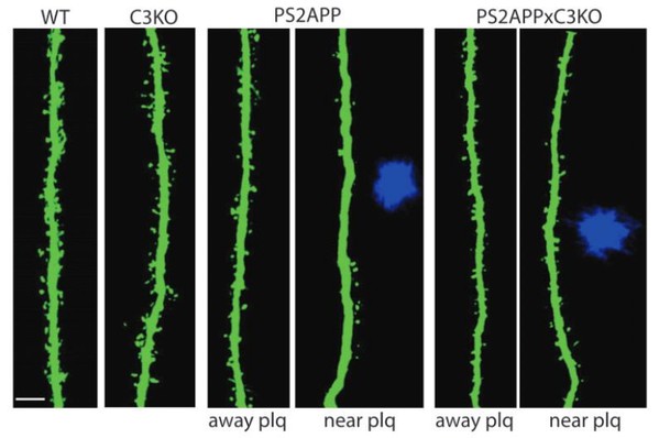圖2 : 老鼠身上帶有棘突的樹突。由左至右：正常老鼠（WT）、C3基因（C3KO）不全的老鼠、PS2APP老鼠（有遠離和靠近斑塊的樹突）、以及PS2APP與C3KO老鼠（有遠離和靠近斑塊的樹突）。Adapted from [1]。