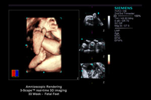 准父母可透过3D超音波技术与NVIDIA 3D Vision眼镜观看母体内清晰细致的胎儿样貌。