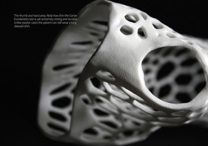 3D列印出的Cortex外骨骼，傷處構造會特別緊密，以加強保護，但仍保有極佳的透氣性。