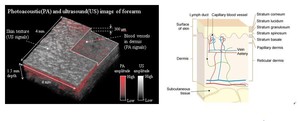 愛德萬測試成功研發出高解析度的新3D成像技術，結合光聲與超音波成像技術取得真皮層的血管網路3D影像。