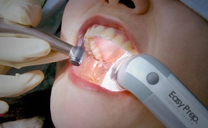 英濟與策略夥伴CEREC Asia共同研發的口腔隔離系統獲各國牙醫好評