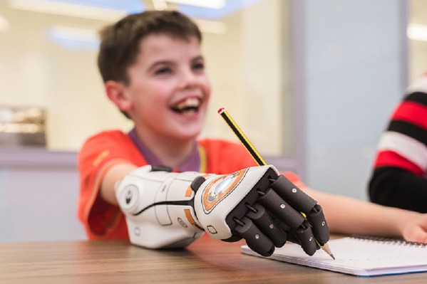 图一 : 11岁的Cameron Millar天生没有右手，4岁时他想要骑单车，并有了人生第一只义肢，但什么事都做不了。现在透过智慧的控制系统演算法，英国仿生手臂厂商Open Bionics为他打造了高自由度、轻巧且可负担的Hero Arm，做起事来变得更顺手。 （source：openbionics.com）