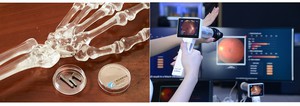 工研院以「促進組織整合仿生3D列印技術（BioMS-Ti）」(圖左)，以及「眼部醫學影像輔助診斷技術（Portable Edge AI-DR）」分別奪下「愛迪生獎」科學與醫藥類一銀一銅的佳績。